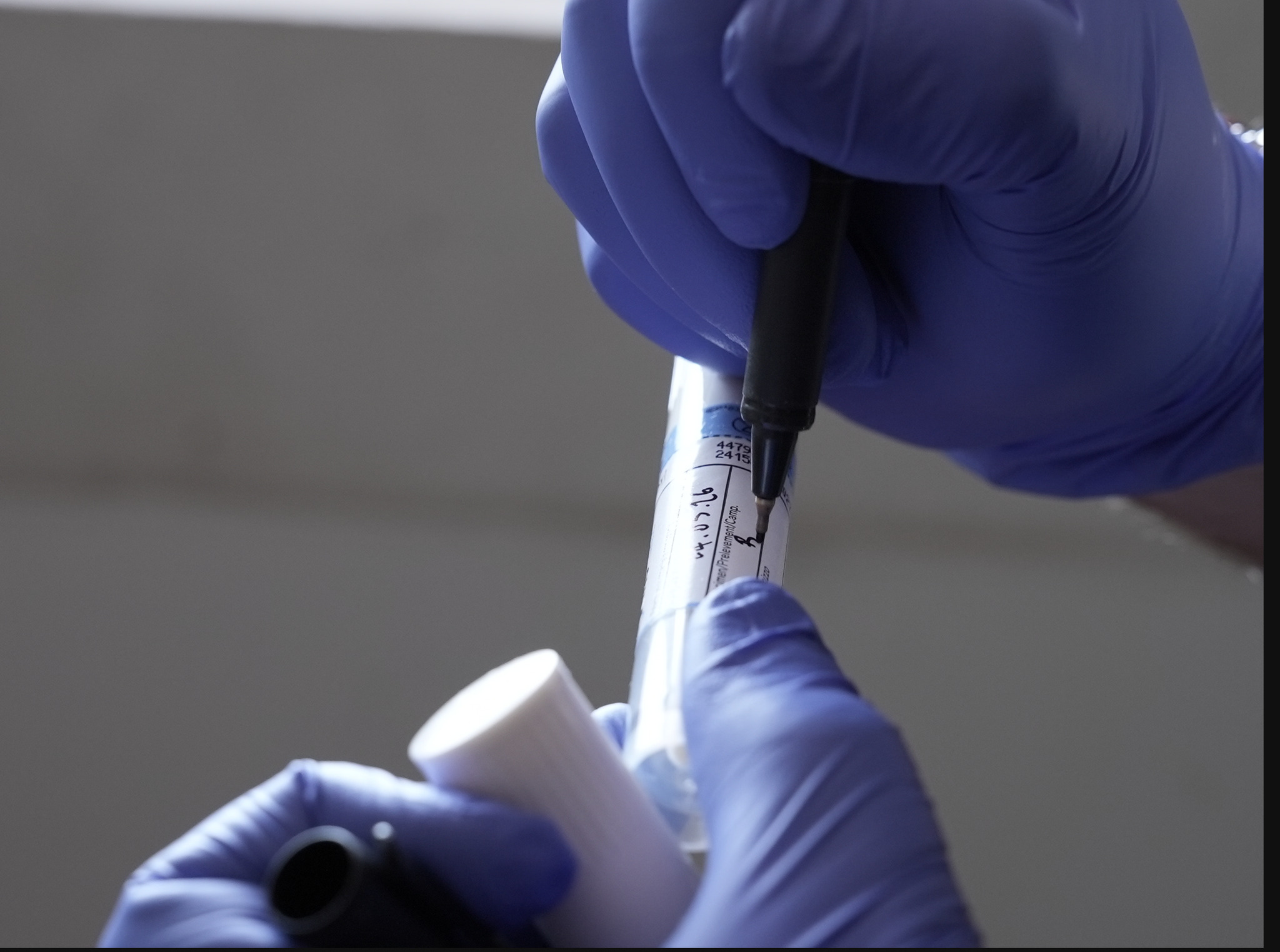 Persona con guanti usa una penna per prelevare campione di DNA da provetta in laboratorio, con sfondo neutro.